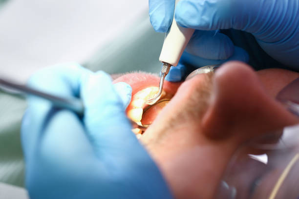 Best Walk-In Emergency Dentist in Fannett, TX