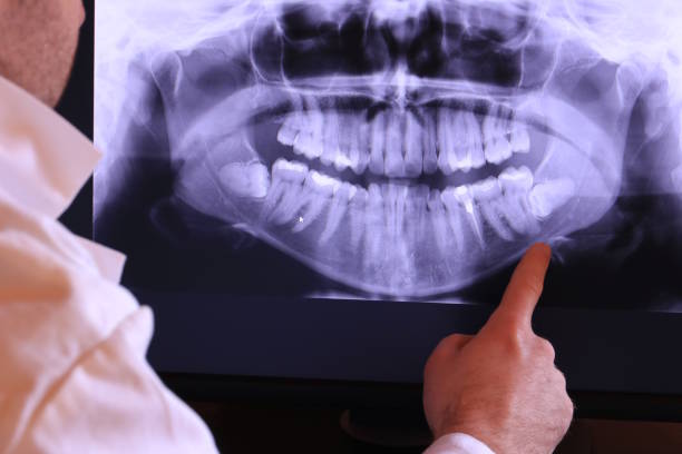 Best Emergency Broken Tooth Repair in Fannett, TX