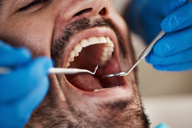 Best Emergency Treatment for Toothache in Fannett, TX